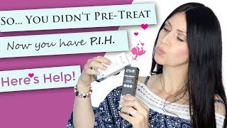 So You have PIH  Chemical Peel Help  Dark Skin  Hyperpigmentation Treatment  Pretreatment [upl. by Hazard62]