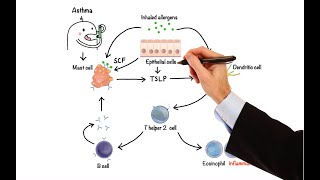 How to recognise and deal with an Asthma attack [upl. by Hugibert]