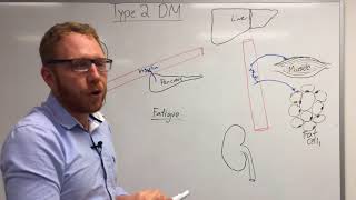 Type 2 Diabetes Pathophysiology [upl. by Aisul]