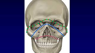 Facial Fractures 1 [upl. by Tessler628]