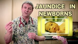 Jaundice in Newborns Pediatric Advice [upl. by Adnawot]