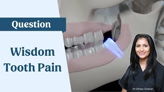 Wisdom tooth pain and advice [upl. by Kosel]