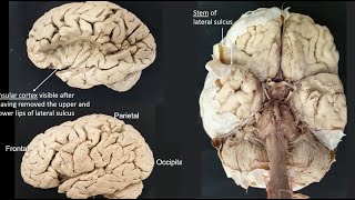 Lateral sulcus [upl. by Gregorio]