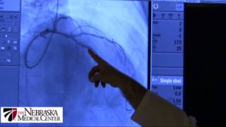 Animated Mitral Stenosis Murmur [upl. by Misha]