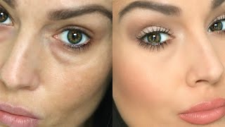 How to Conceal Under Eye Circles  Bags [upl. by Wolenik753]