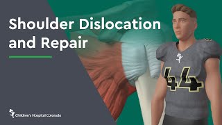 Traumatic Knee Dislocation ReductionQuick Version [upl. by Josephine104]