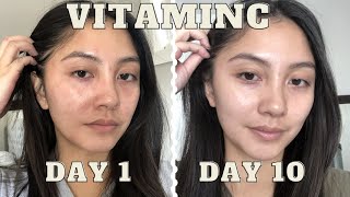 adding VITAMIN C serum to my skincare routine for 10 days  Vichy LiftActiv before amp after [upl. by Tuorah726]