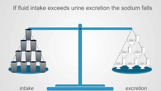 Hyponatremia Basics Understanding Water Intake amp Urine Output [upl. by Atiker467]