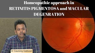 Homeopathic approach in RETINITIS PIGMENTOSA and MACULAR DEGENERATION Dr Gaurang Gaikwad [upl. by Bedell9]