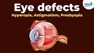 Eye defects  Hyperopia Astigmatism Presbyopia  Dont Memorise [upl. by Billye]