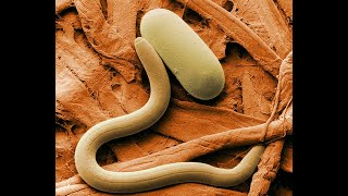 What are nematodes [upl. by Aihsa171]