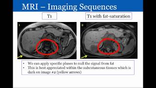 Introduction to Radiology Magnetic Resonance Imaging [upl. by Alexia]