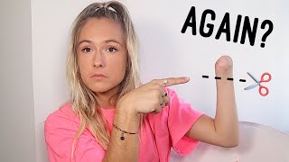 I Had To Get My Arm Amputated AGAIN  Amputee Storytime [upl. by Jack]