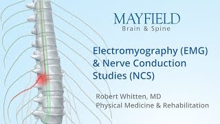 Electromyography EMG amp Nerve conduction studies NCS [upl. by Nyrol]