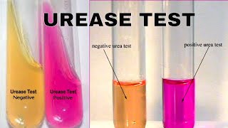 Urea Hydrolysis Urease Test [upl. by Hooker]