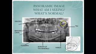 Radiographic Interpretation of Dental Anatomy [upl. by Liryc]