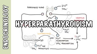 Hyperparathyroidism and the different types causes pathophysiology treatment [upl. by Olen]