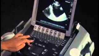 How To Ultrasound FAST Exam  Male Pelvis [upl. by Ulphi]