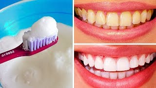 10 Natural Ways to Whiten Teeth at Home [upl. by Smitt]