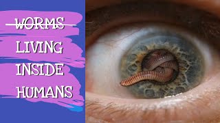 WORMS LIVING INSIDE HUMANS  EXPLAINED [upl. by Faydra671]