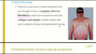 Cushings syndrome and its treatment [upl. by Arikaahs]