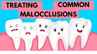 Management of Common Malocclusions Orthodontics [upl. by Ober]