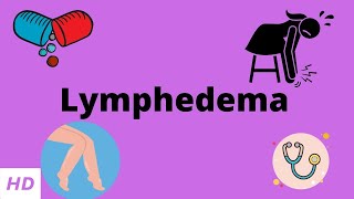 Top 3 Exercises for Leg Lymphedema Swelling or Edema [upl. by Naeruat]