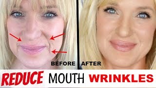 Get RID Of MOUTH WRINKLES WithOUT Fillers [upl. by Budwig]