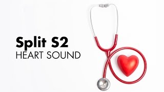 Fixed Split S2  Heart Sounds  MEDZCOOL [upl. by Schuman519]