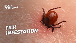 WARNING The Most Horrific Tick Infestations [upl. by Airamas]