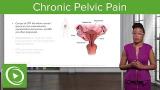 Chronic Pelvic Pain CPP Definition Diagnosis amp Management – Gynecology  Lecturio [upl. by Prendergast328]