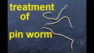 treatment of pin worms [upl. by Kahcztiy502]