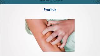 Pruritus  Dermatology  EduRx [upl. by Tymon]