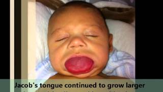 Trisomy 21 Down Syndrome Introduction – Pediatrics  Lecturio [upl. by Nadeen422]