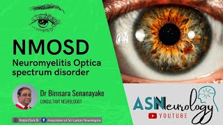 2020 RNDS  What is Neuromyelitis Optica Spectrum Disorder NMOSD [upl. by Konstantin]