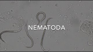 Nematodes [upl. by Buschi]