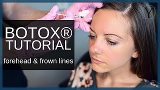 BOTOX® Injection  Forehead Wrinkles and Frown Lines  Atlanta Botox® [upl. by Leihcim]