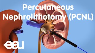 Part 3 Neuro Urology in Daily Practice  Urodynamics [upl. by Amado321]