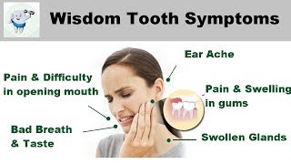 Wisdom Teeth Symptoms [upl. by Ainelec]