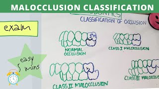 malocclusion of teeth I orthodontics lecture [upl. by Goddart]