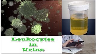 Leukocytes in Urine  No Nitrates [upl. by Ilrahs115]