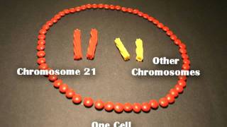 Nondisjunction Trisomy 21  An Animated Tutorial [upl. by Nauqyaj455]