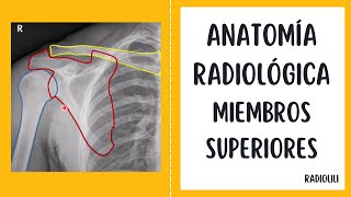 Anatomía Radiológica  Radiología Convencional Miembros Superiores [upl. by Hoo]