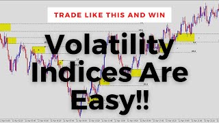 How To Trade Volatility Indices Institutional Trading Strategies [upl. by Duj]