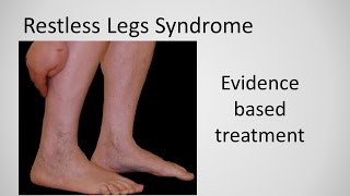 Restless Leg Syndrome evidence based treatment [upl. by Yremogtnom]