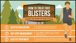 How To Treat Foot Blisters Like A Pro [upl. by Xenophon459]