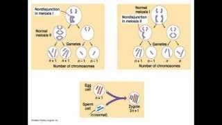 Chromosomal abnormalities [upl. by Elisabetta]