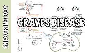 Graves Disease  Overview causes pathophysiology investigations and treatment [upl. by Attehcnoc]