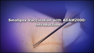 Chapter 1 Smallpox Vaccination with ACAM2000 Introduction [upl. by Jacobson]