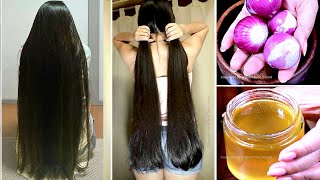 1 Week Challenge  Grow Your Hair Super Faster  After Doing this Your Hair will Never Stop Growing [upl. by Sesom]